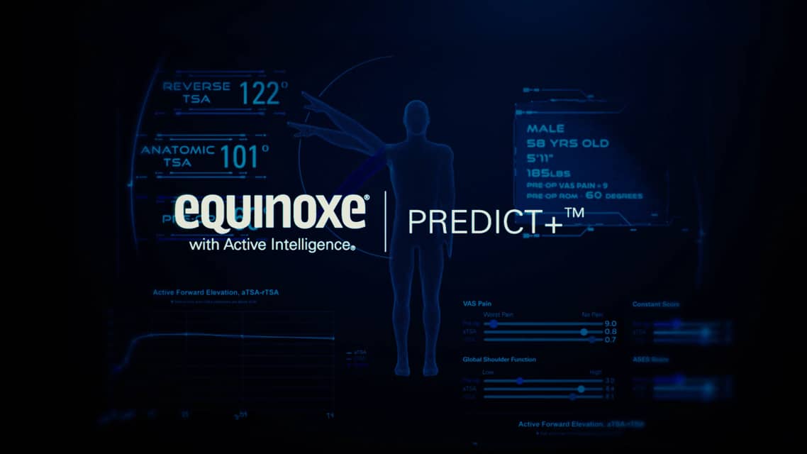 Exactech Equinoxe with Active Intelligence Predict+