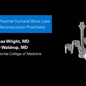 Exactech Reverse TSA for Proximal Humeral Bone Loss: The Humeral Reconstruction Prosthesis with Thomas Wright, MD and Larry Waldrop, MD